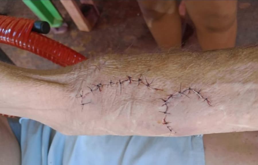 Mais uma vítima: idoso também é atacado por mulher em semáforo de Sidrolândia