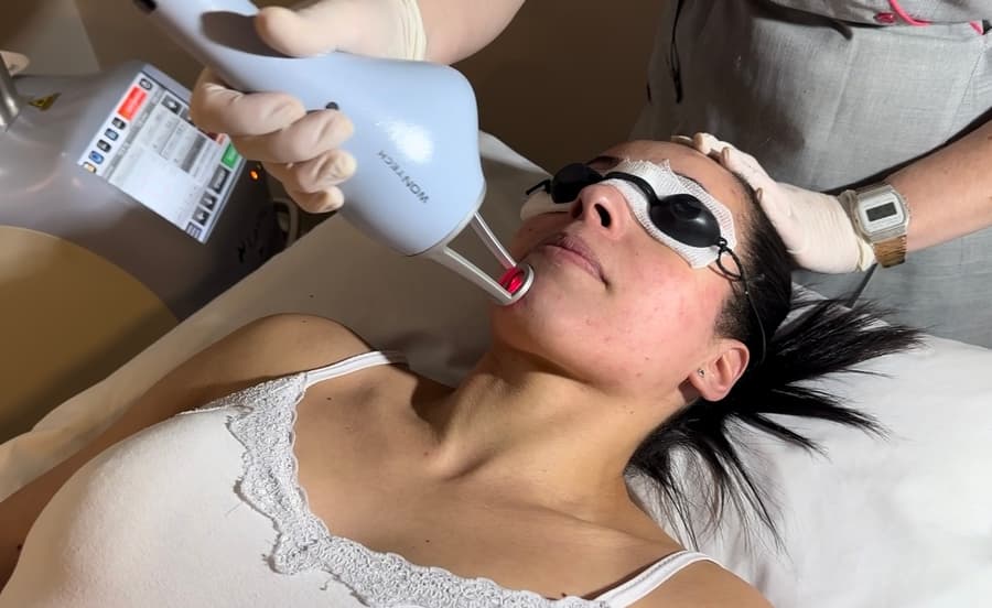 Spazen realiza Lavieen nesta quarta-feira, procedimento que promete rejuvenescer e revitalizar a pele