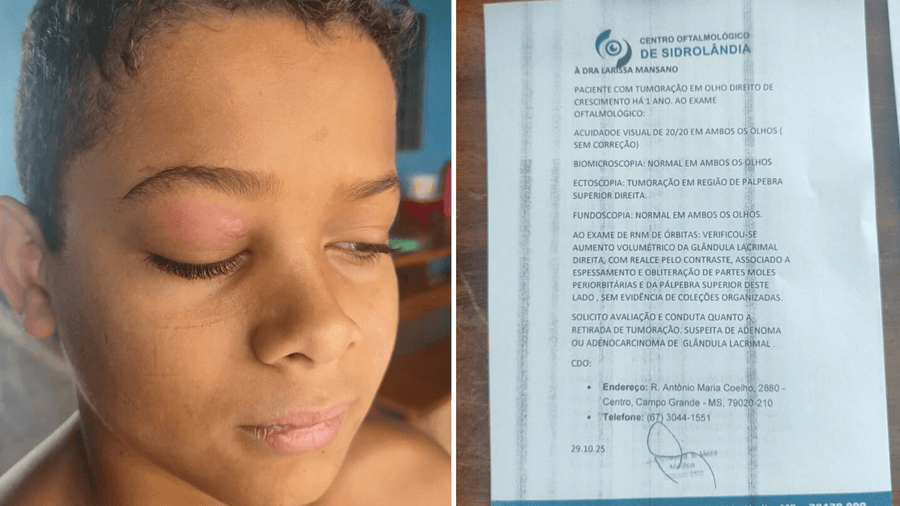 Em Sidrolândia, mãe pede ajuda para custear cirurgia e retirar tumor no olho do filho de 11 anos