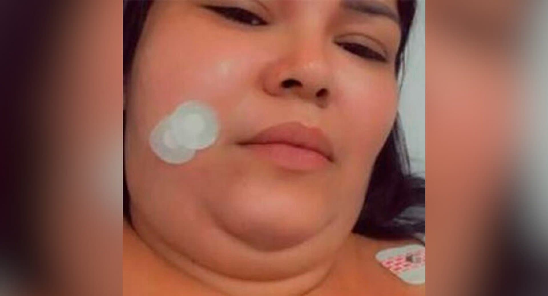 Moradora de Sidrolândia sofre com neuralgia do trigêmeo e pede ajuda para custear cirurgia de R$ 73,6 mil