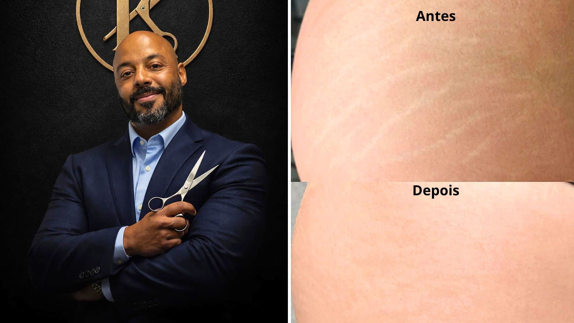 Spazen anuncia novo profissional e amplia serviços na área de estética em Sidrolândia