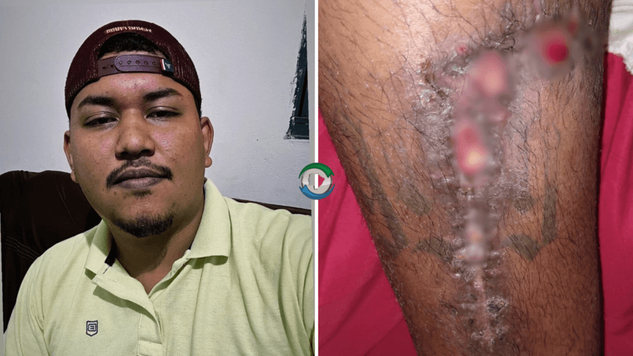 Morador de Sidrolândia cria rifa para custear tratamento de tumor na perna