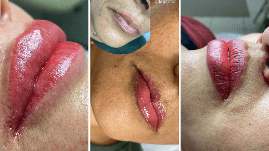 Promoção: Spazen oferece micropigmentação labial por apenas R$ 280,00 reais