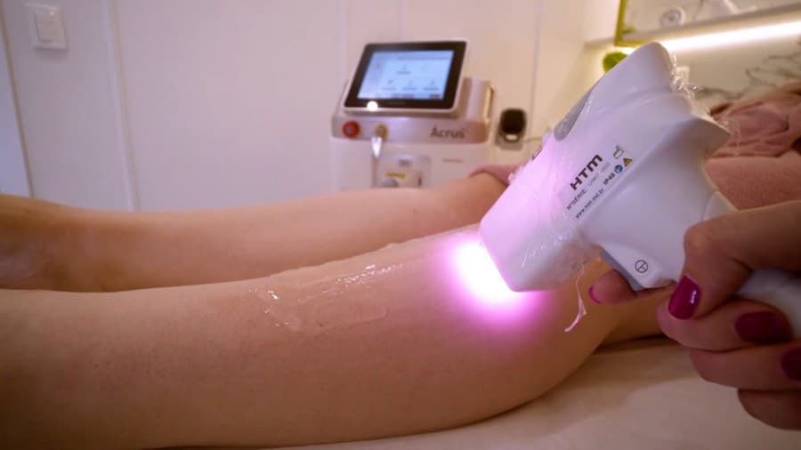 Spazen realiza dia do laser com sessões a partir de R$ 40,00 neste sábado