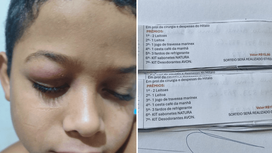 Mãe organiza rifa em Sidrolândia para custear cirurgia de retirada de tumor no olho do filho