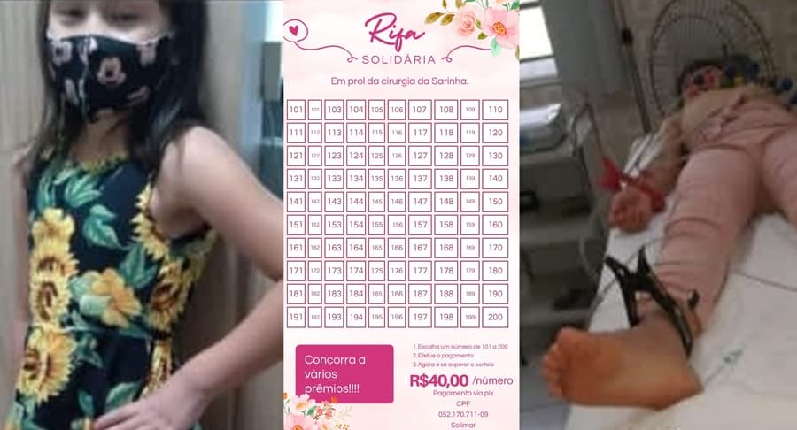 Familiares fazem rifas para custear cirurgia de criança de apenas 8 anos de idade