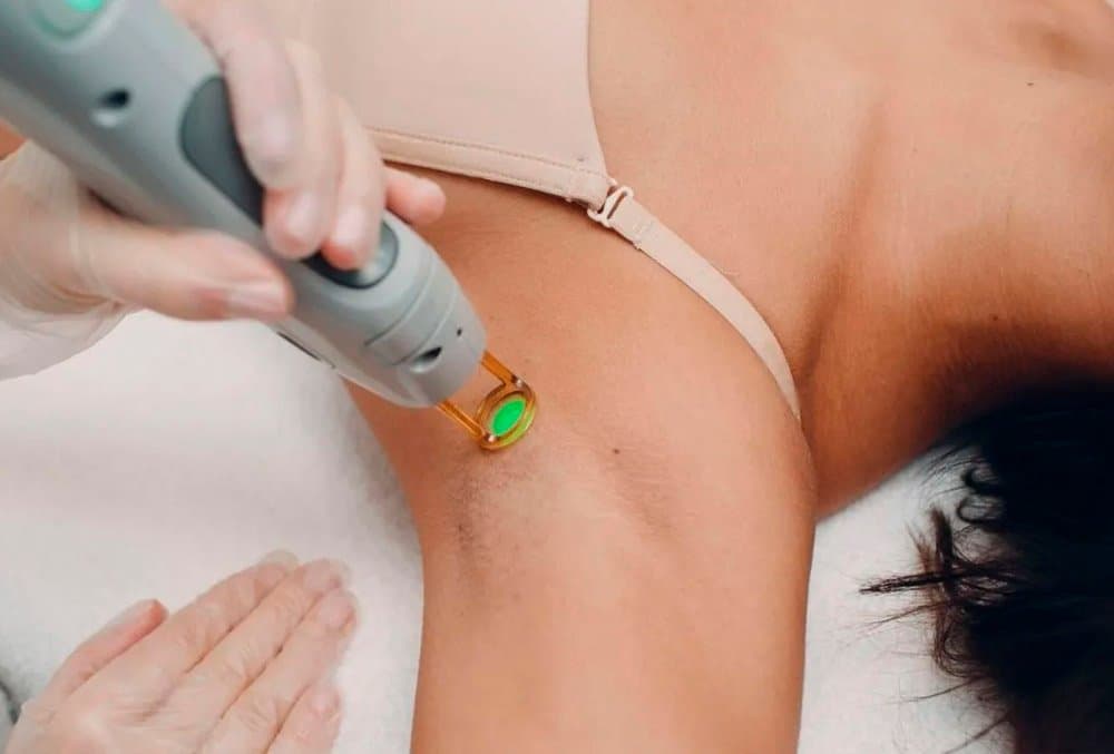 Em Sidrolândia, Spazen realiza dia de depilação a laser neste sábado