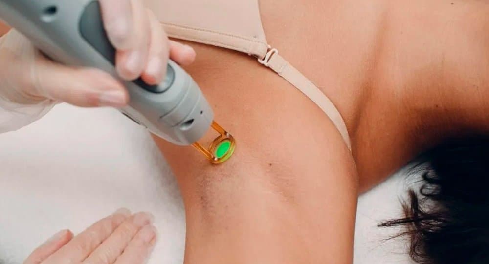 Em Sidrolândia, Spazen realiza dia de depilação a laser neste sábado
