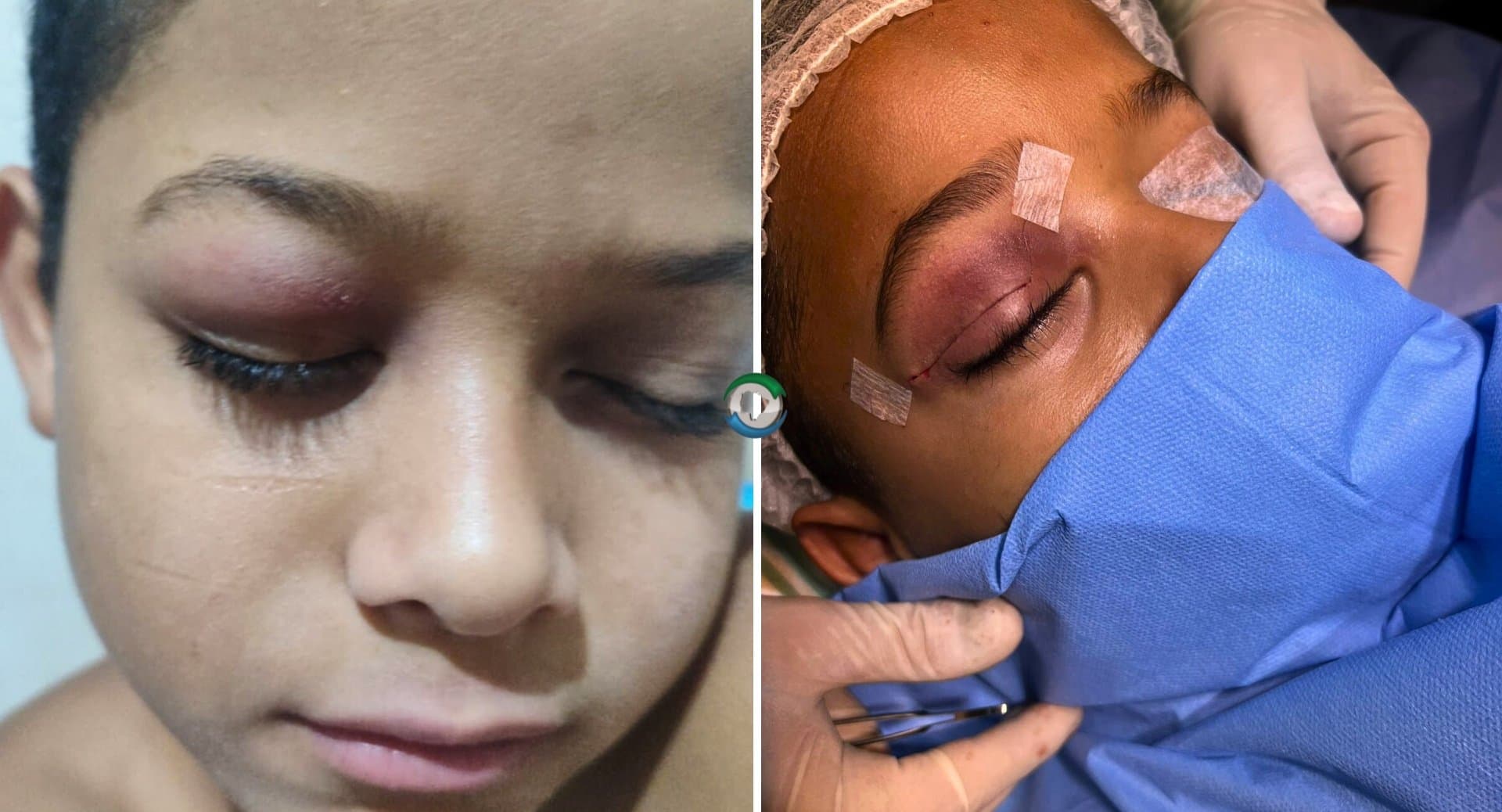 Mãe sidrolandense comemora cirurgia do filho de 11 anos após apoio da prefeitura e da comunidade